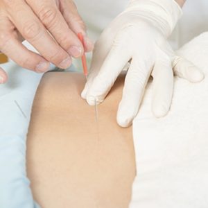 痛みや不調には鍼をどうぞ